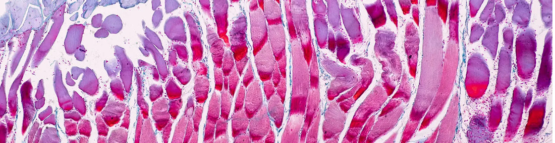 article-page-carousel-item--AKG Protects Skeletal Muscle in Aging Mice