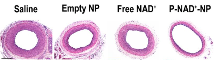 article-page-carousel-item--NAD+ Nanoparticle Injection Decreased Blood Vessel Damage In Rats