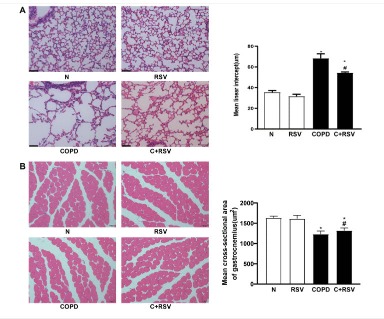 article-page-carousel-item--Resveratrol Prevents Skeletal Muscle Atrophy and Senescence