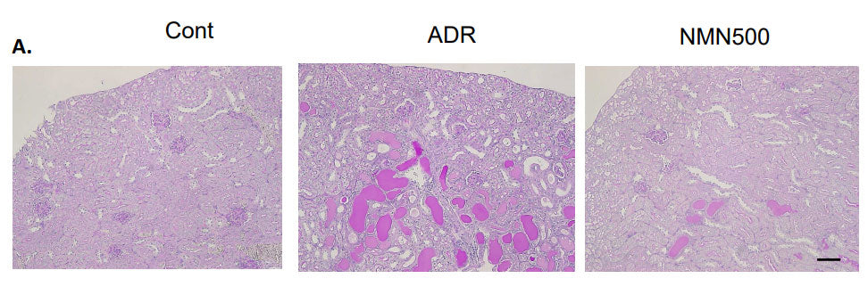 article-page-carousel-item--NMN restores kidney function and prevents kidney damage